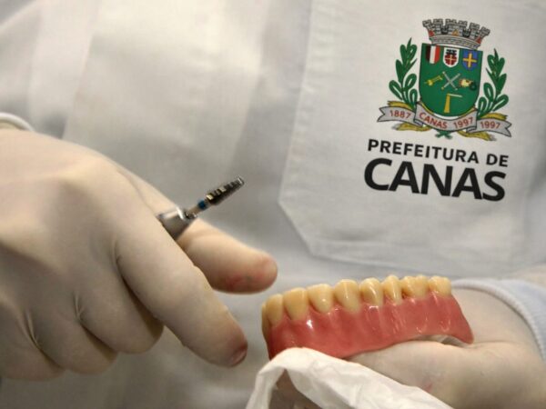 𝐂𝐚𝐧𝐚𝐬 𝐫𝐞𝐭𝐨𝐦𝐚 𝐚𝐭𝐞𝐧𝐝𝐢𝐦𝐞𝐧𝐭𝐨 𝐝𝐞 𝐩𝐫𝐨́𝐭𝐞𝐬𝐞𝐬 𝐝𝐞𝐧𝐭𝐚́𝐫𝐢𝐚𝐬